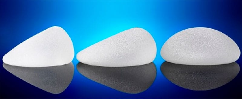 MASTOPLASTICA ADDITIVA 2 protesi-mammarie