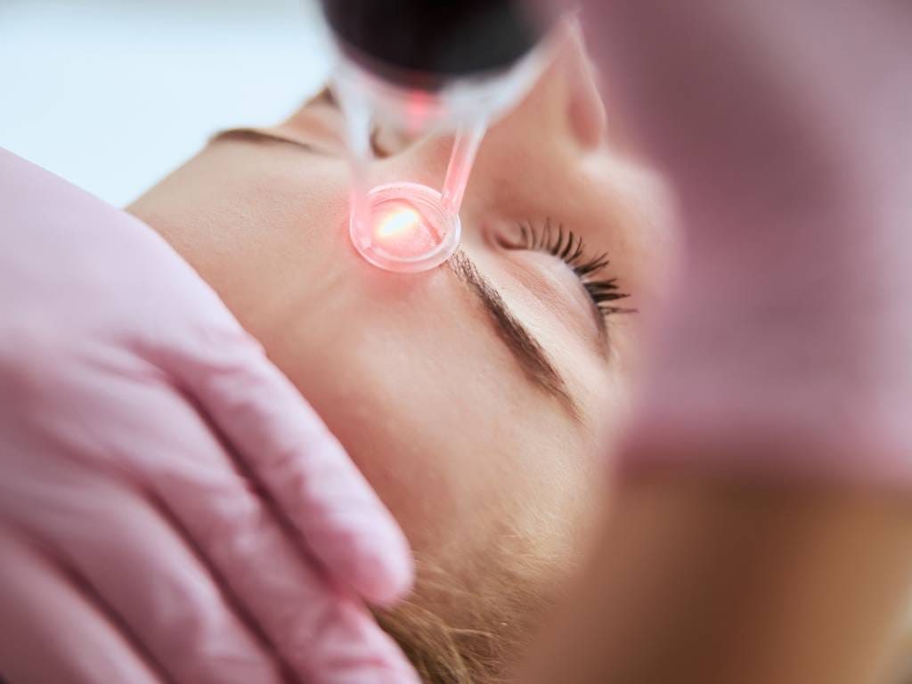 trattamenti laser